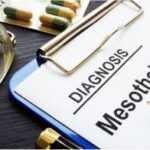 Mesothelioma Treatment: A Comprehensive Guide to Fighting the Battle